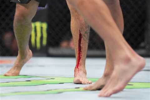 UFC star Tony Ferguson shows off gruesome leg gash as blood pours from wound in brutal Nate Diaz..