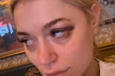 ‘War wounds’ – OnlyFans star-turned-boxer Elle Brooke shows off two black eyes after sparring with..