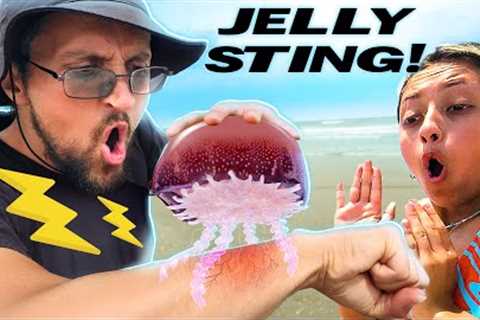 Stinging myself with Jellyfish to get Family Reactions (PRANK)