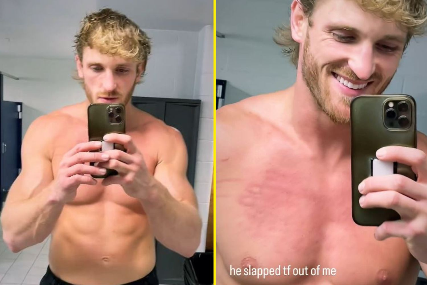 Logan Paul shows off war wounds from Royal Rumble as WWE star defeats Kevin Owens